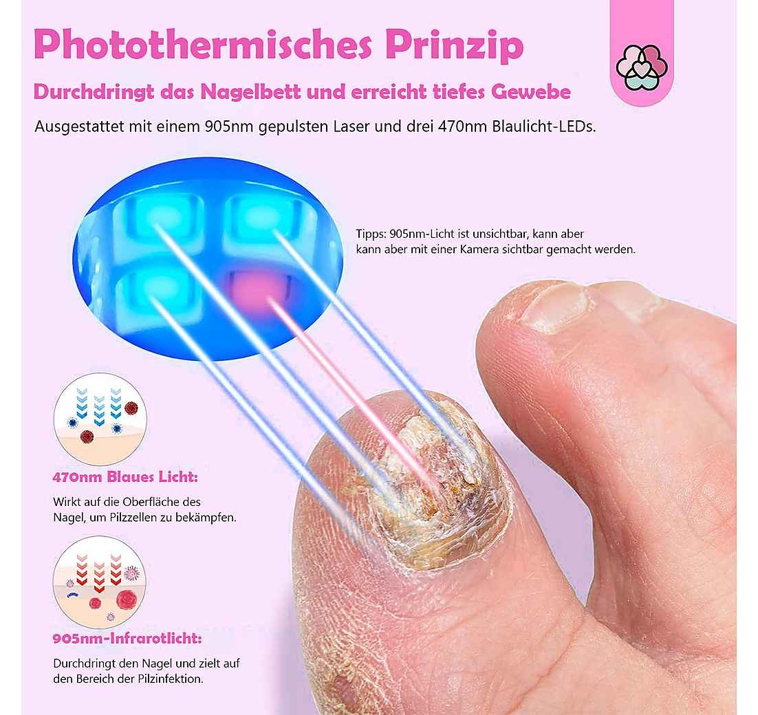 WohlErbe NagelFix